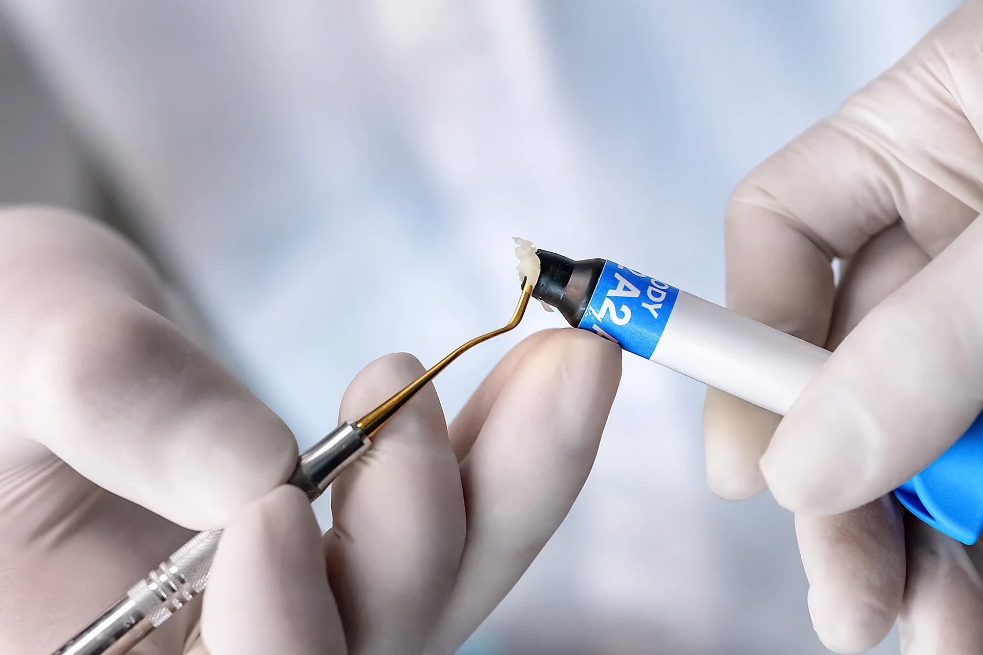 Gloved hands dispensing tooth-colored composite from a syringe onto a dental instrument