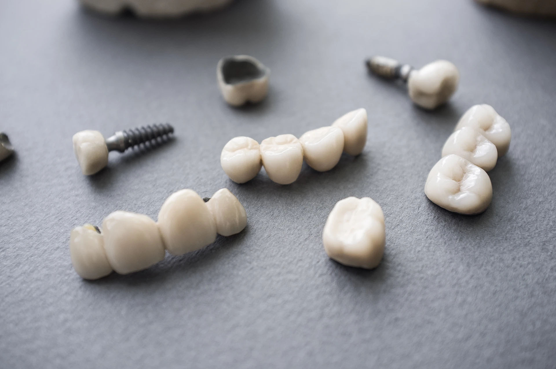 Assorted ceramic dental crowns, bridges and an implant arranged on a gray surface