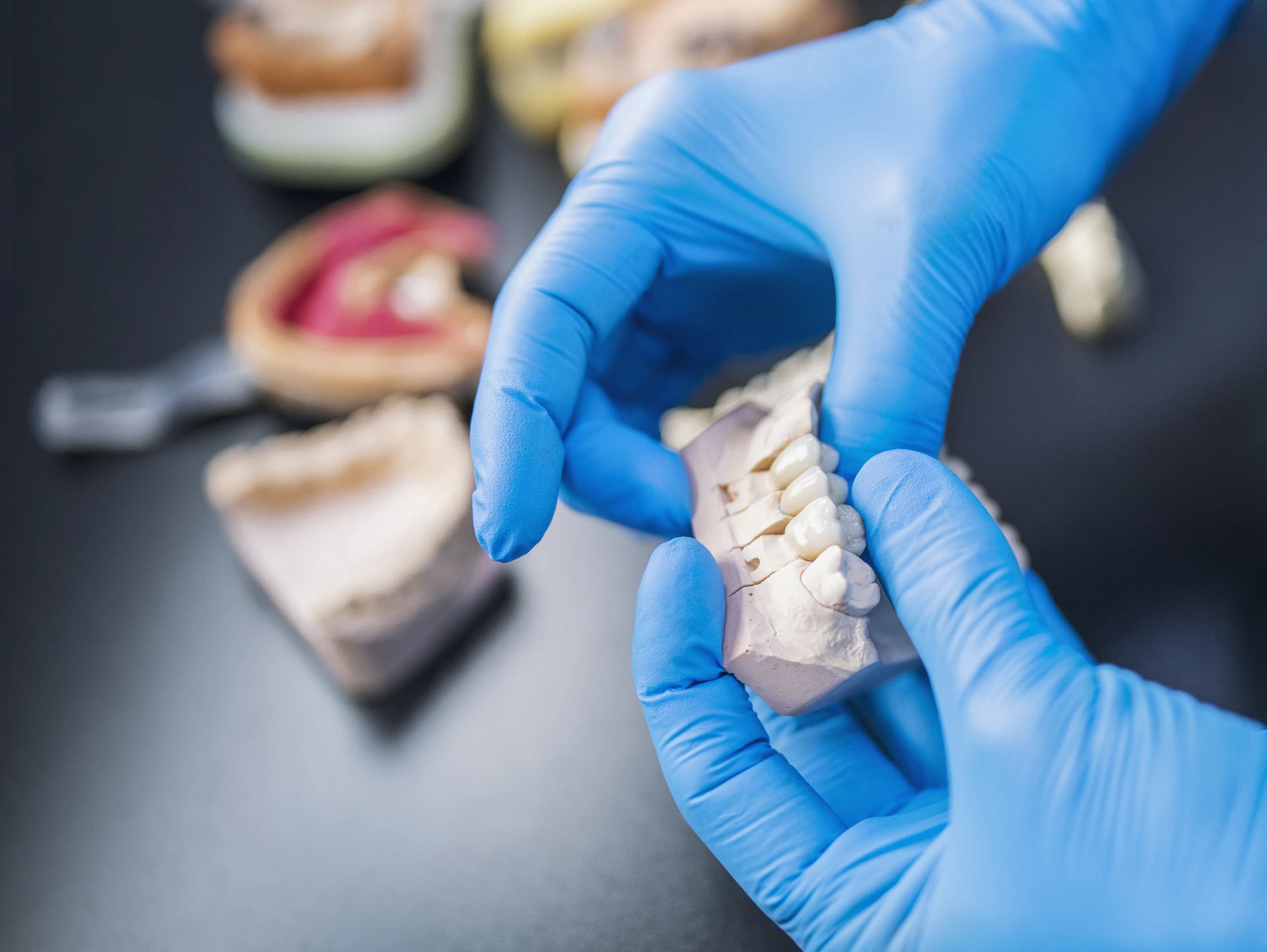 Blue-gloved hands holding a plaster dental model with crowns, with more models on the lab bench behind