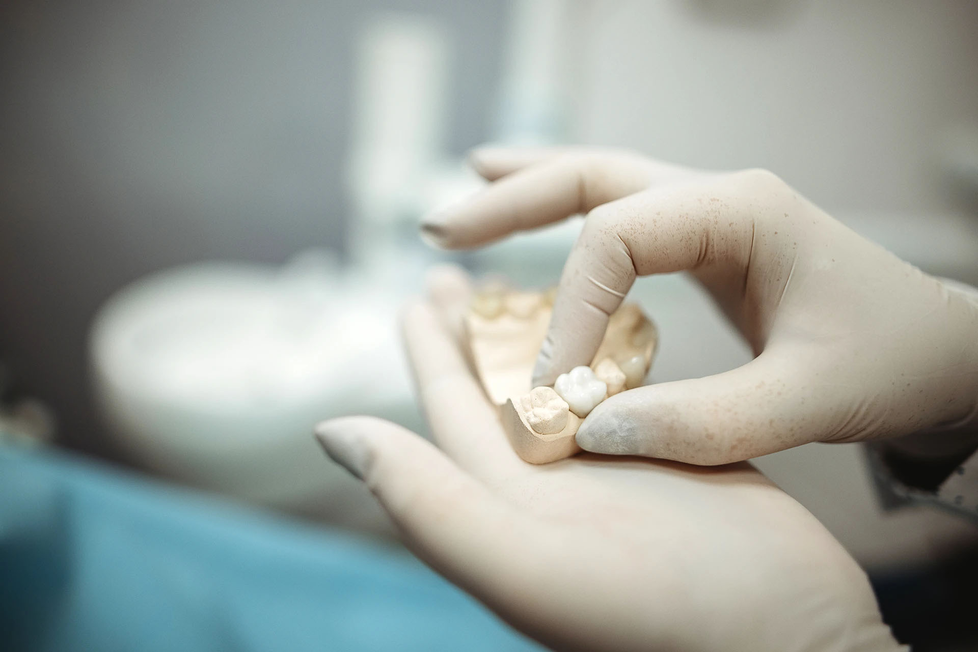 Blue-gloved hands holding a plaster dental model of the lower molars on a dark lab surface