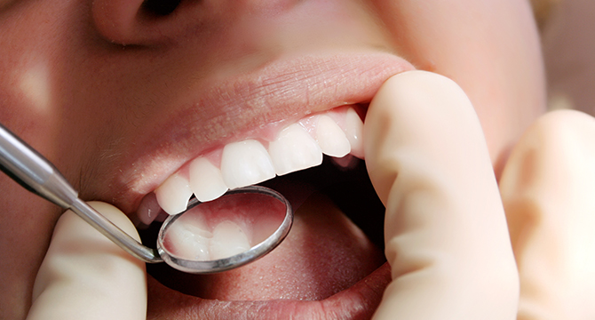 Mouth mirror exam, close-up