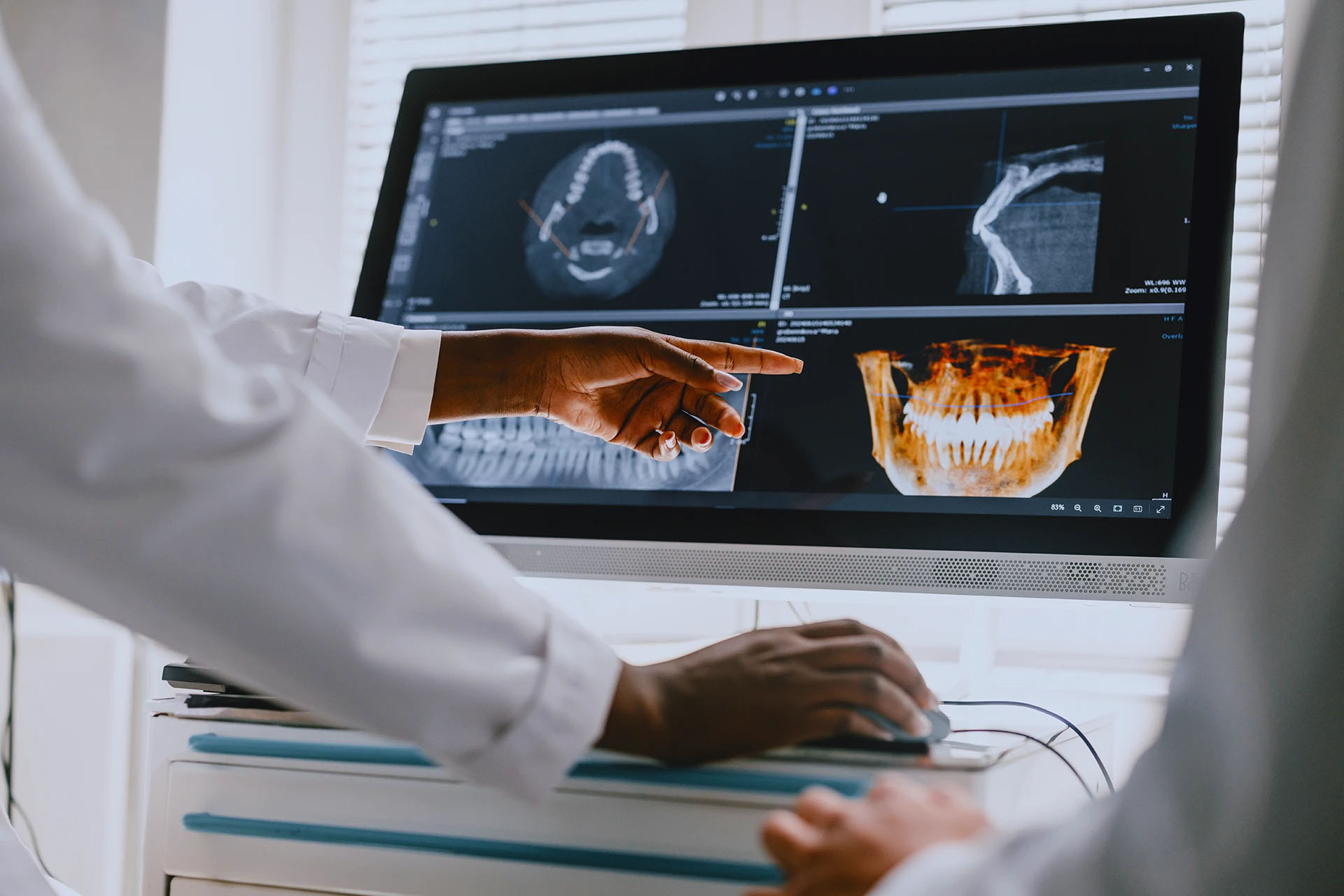 Dental professional pointing at a CBCT 3D dental scan of the jaw on a monitor