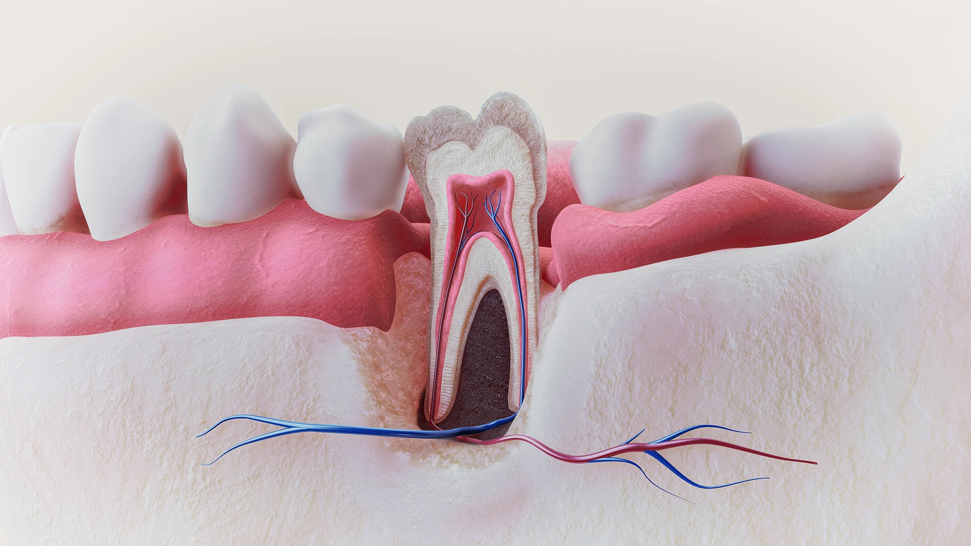 Three-dimensional cross-section illustration of a tooth showing the pulp, root canals, nerves and blood vessels